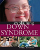 Explaining_Down_syndrome